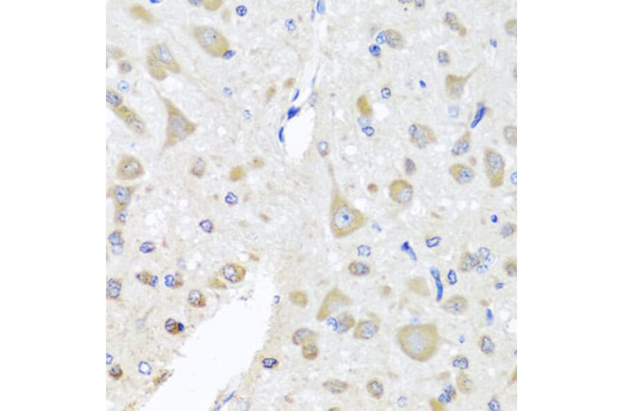 Immunohistochemistry - Anti-PCID1 Antibody (A14562) - Antibodies.com