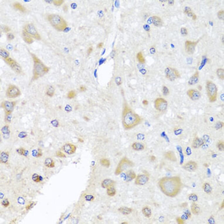 Immunohistochemistry - Anti-PCID1 Antibody (A14562) - Antibodies.com