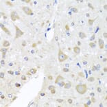Immunohistochemistry - Anti-PCID1 Antibody (A14562) - Antibodies.com