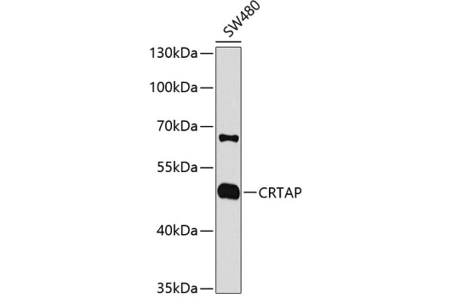 Western Blot - Anti-CRTAP/CASP Antibody (A14563) - Antibodies.com