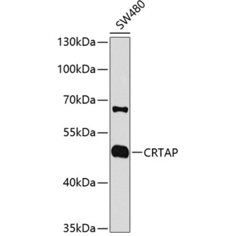 Western Blot - Anti-CRTAP/CASP Antibody (A14563) - Antibodies.com