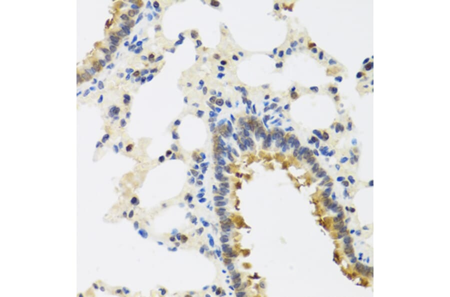 Immunohistochemistry - Anti-CRTAP/CASP Antibody (A14563) - Antibodies.com