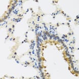 Immunohistochemistry - Anti-CRTAP/CASP Antibody (A14563) - Antibodies.com