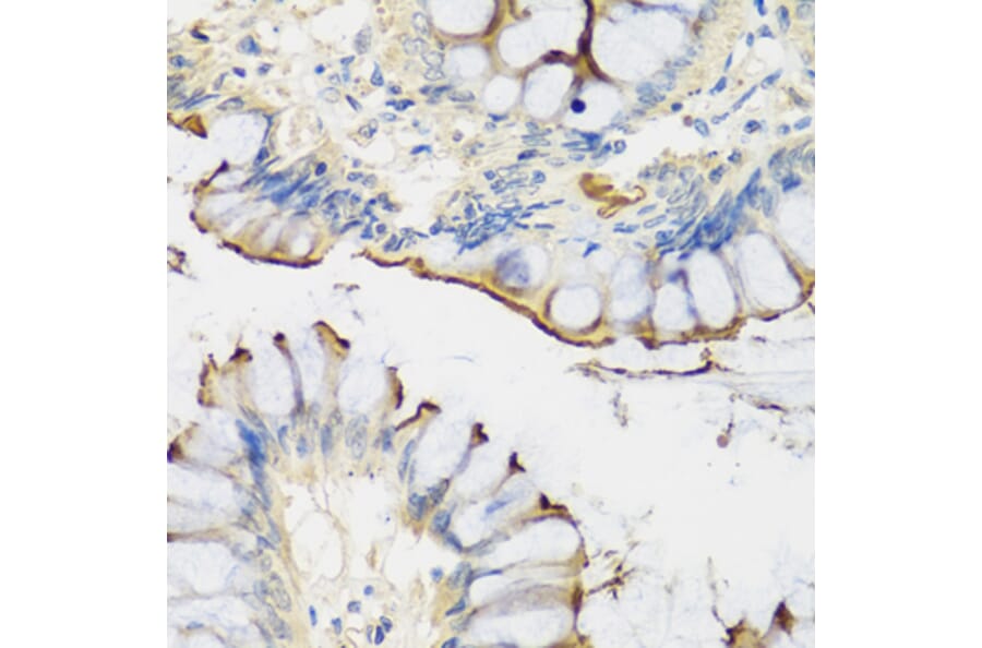 Immunohistochemistry - Anti-CRTAP/CASP Antibody (A14563) - Antibodies.com