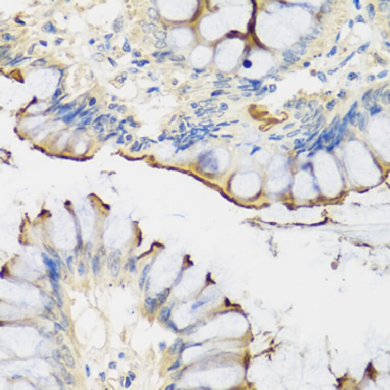 Immunohistochemistry - Anti-CRTAP/CASP Antibody (A14563) - Antibodies.com