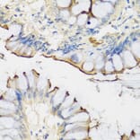 Immunohistochemistry - Anti-CRTAP/CASP Antibody (A14563) - Antibodies.com