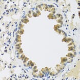 Immunohistochemistry - Anti-CRTAP/CASP Antibody (A14563) - Antibodies.com