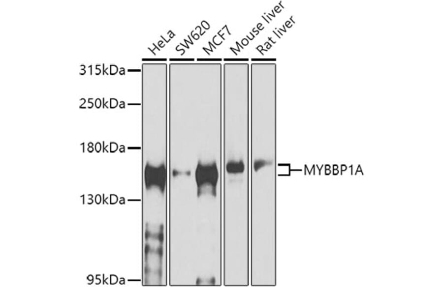 Western Blot - Anti-MYBBP1A Antibody (A14564) - Antibodies.com