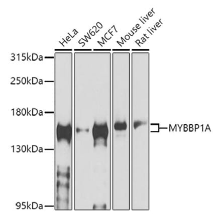 Western Blot - Anti-MYBBP1A Antibody (A14564) - Antibodies.com