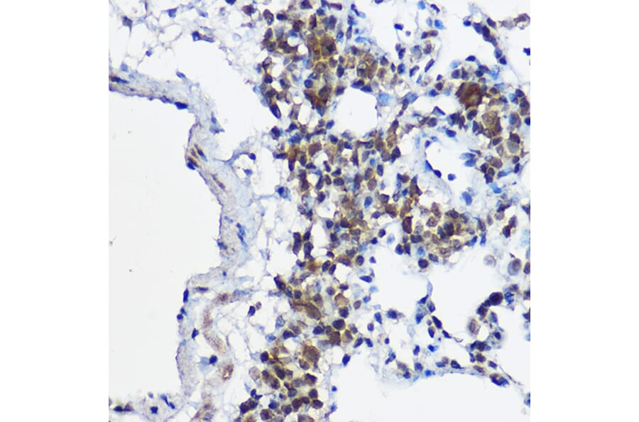 Immunohistochemistry - Anti-MYBBP1A Antibody (A14564) - Antibodies.com