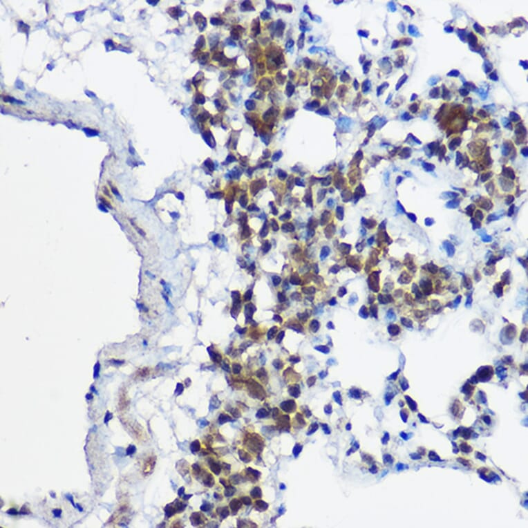 Immunohistochemistry - Anti-MYBBP1A Antibody (A14564) - Antibodies.com