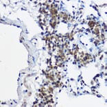 Immunohistochemistry - Anti-MYBBP1A Antibody (A14564) - Antibodies.com