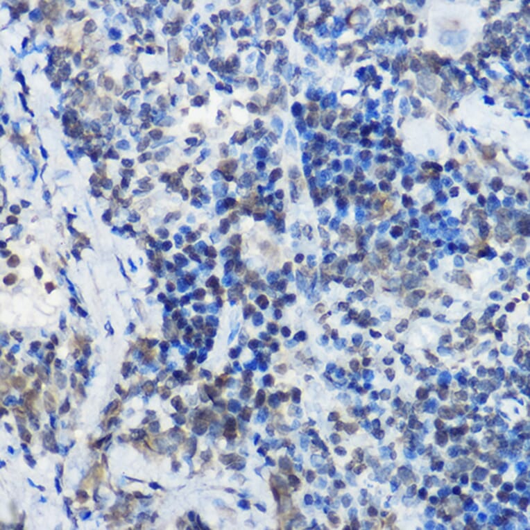 Immunohistochemistry - Anti-MYBBP1A Antibody (A14564) - Antibodies.com