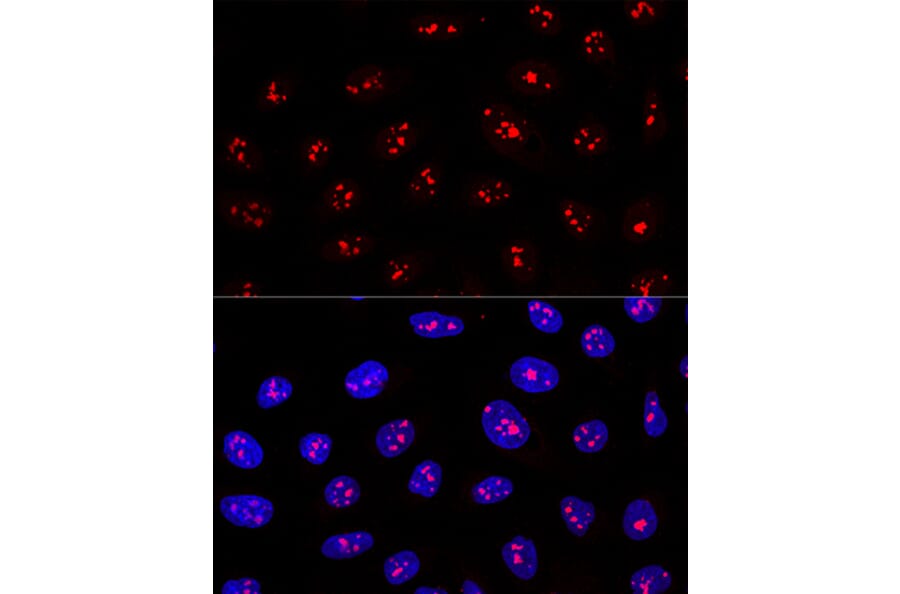 Immunofluorescence - Anti-MYBBP1A Antibody (A14564) - Antibodies.com