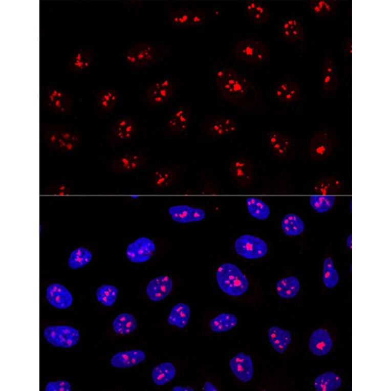 Immunofluorescence - Anti-MYBBP1A Antibody (A14564) - Antibodies.com