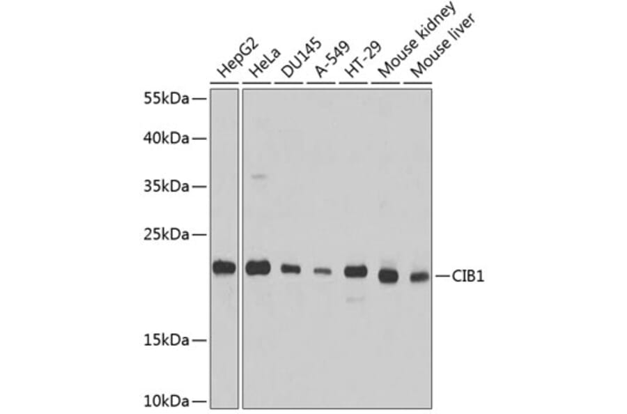 Western Blot - Anti-CIB1/KIP Antibody (A14565) - Antibodies.com
