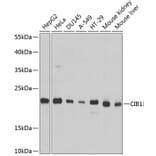 Western Blot - Anti-CIB1/KIP Antibody (A14565) - Antibodies.com