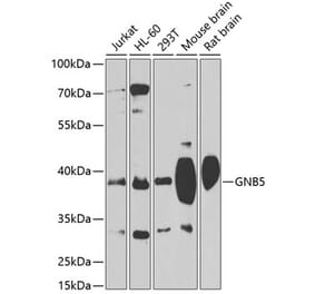 Western Blot - Anti-Gbeta5 Antibody (A14567) - Antibodies.com