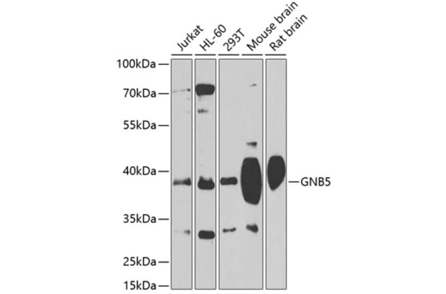 Western Blot - Anti-Gbeta5 Antibody (A14567) - Antibodies.com
