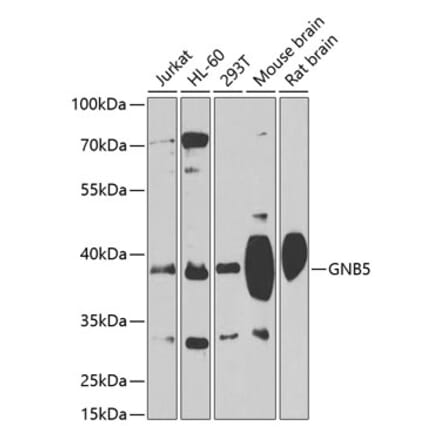 Western Blot - Anti-Gbeta5 Antibody (A14567) - Antibodies.com
