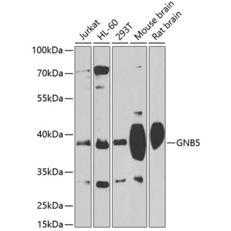 Western Blot - Anti-Gbeta5 Antibody (A14567) - Antibodies.com