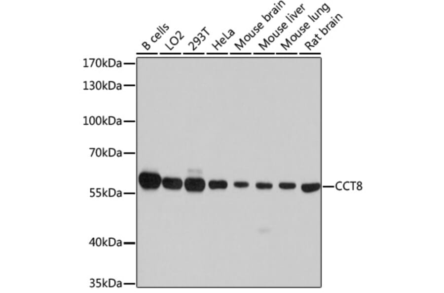 Western Blot - Anti-TCP1 theta Antibody (A14568) - Antibodies.com