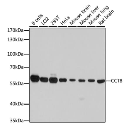 Western Blot - Anti-TCP1 theta Antibody (A14568) - Antibodies.com