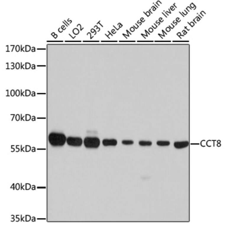 Western Blot - Anti-TCP1 theta Antibody (A14568) - Antibodies.com