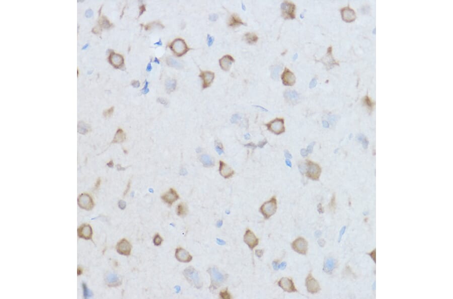 Immunohistochemistry - Anti-TCP1 theta Antibody (A14568) - Antibodies.com
