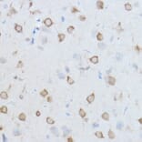 Immunohistochemistry - Anti-TCP1 theta Antibody (A14568) - Antibodies.com