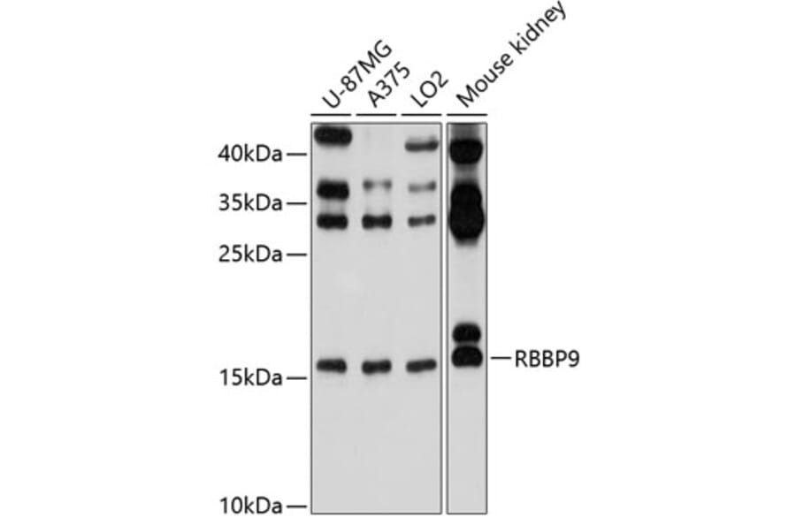 Western Blot - Anti-BOG Antibody (A14569) - Antibodies.com