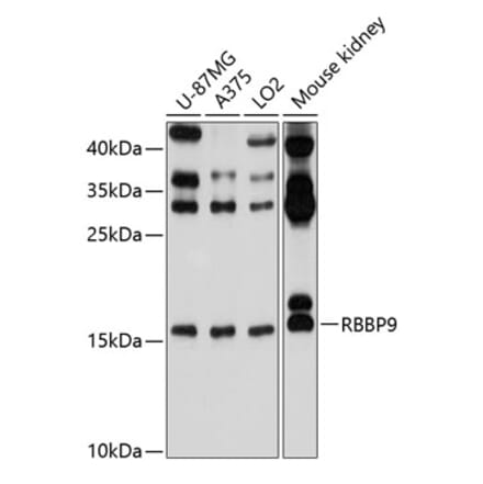 Western Blot - Anti-BOG Antibody (A14569) - Antibodies.com