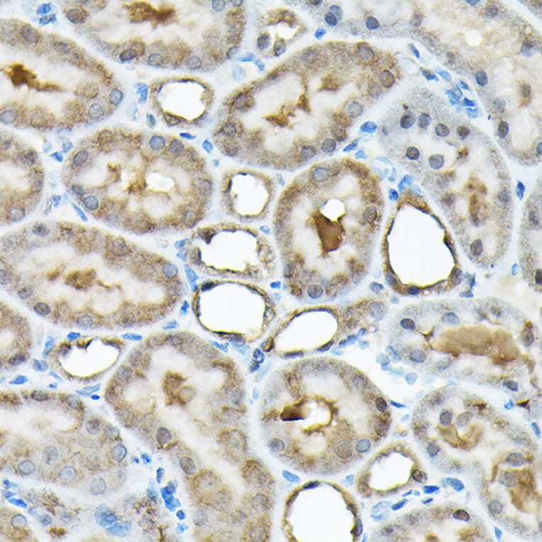 Immunohistochemistry - Anti-BOG Antibody (A14569) - Antibodies.com