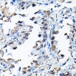 Immunohistochemistry - Anti-BOG Antibody (A14569) - Antibodies.com