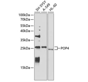 Western Blot - Anti-RPP29 Antibody (A14570) - Antibodies.com