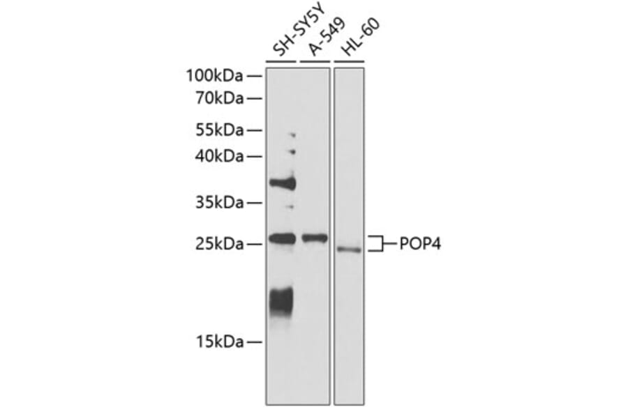 Western Blot - Anti-RPP29 Antibody (A14570) - Antibodies.com