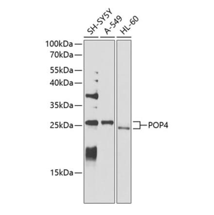 Western Blot - Anti-RPP29 Antibody (A14570) - Antibodies.com