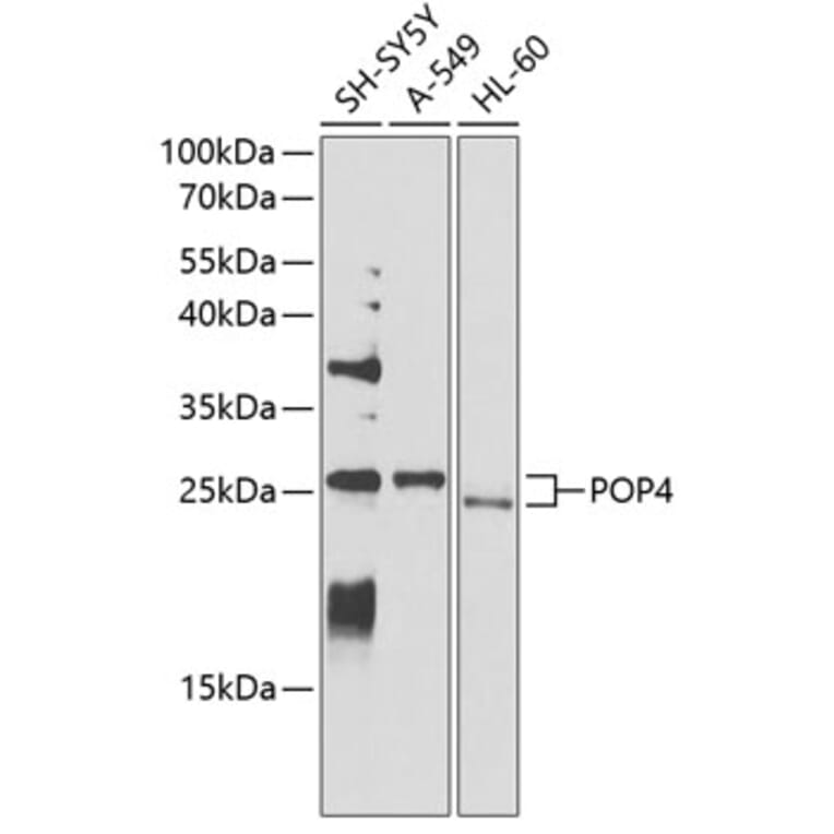 Western Blot - Anti-RPP29 Antibody (A14570) - Antibodies.com
