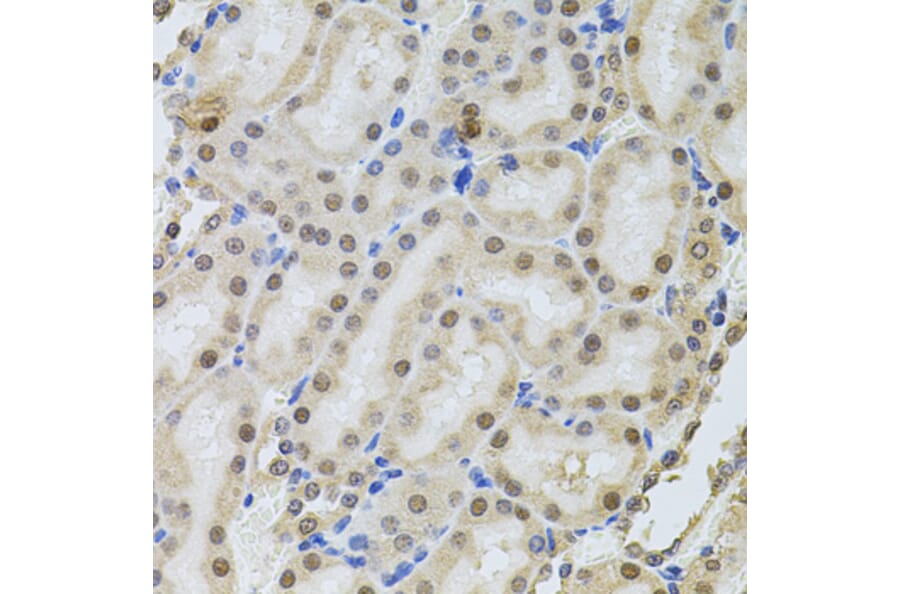 Immunohistochemistry - Anti-RPP29 Antibody (A14570) - Antibodies.com