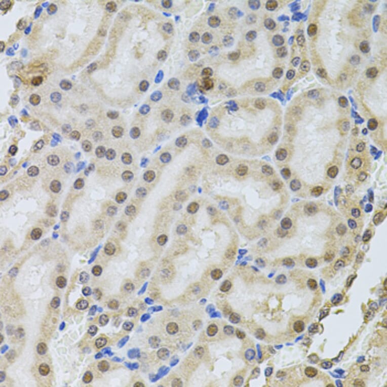 Immunohistochemistry - Anti-RPP29 Antibody (A14570) - Antibodies.com
