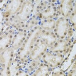 Immunohistochemistry - Anti-RPP29 Antibody (A14570) - Antibodies.com