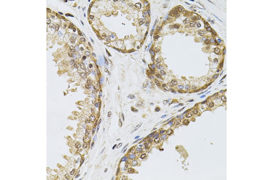 Immunohistochemistry - Anti-RPP29 Antibody (A14570) - Antibodies.com