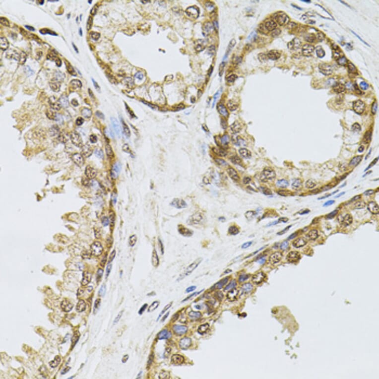 Immunohistochemistry - Anti-RPP29 Antibody (A14570) - Antibodies.com