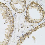 Immunohistochemistry - Anti-RPP29 Antibody (A14570) - Antibodies.com