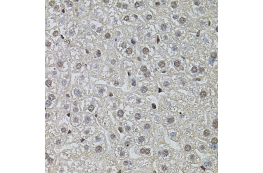 Immunohistochemistry - Anti-RPP29 Antibody (A14570) - Antibodies.com