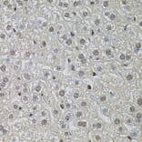 Immunohistochemistry - Anti-RPP29 Antibody (A14570) - Antibodies.com