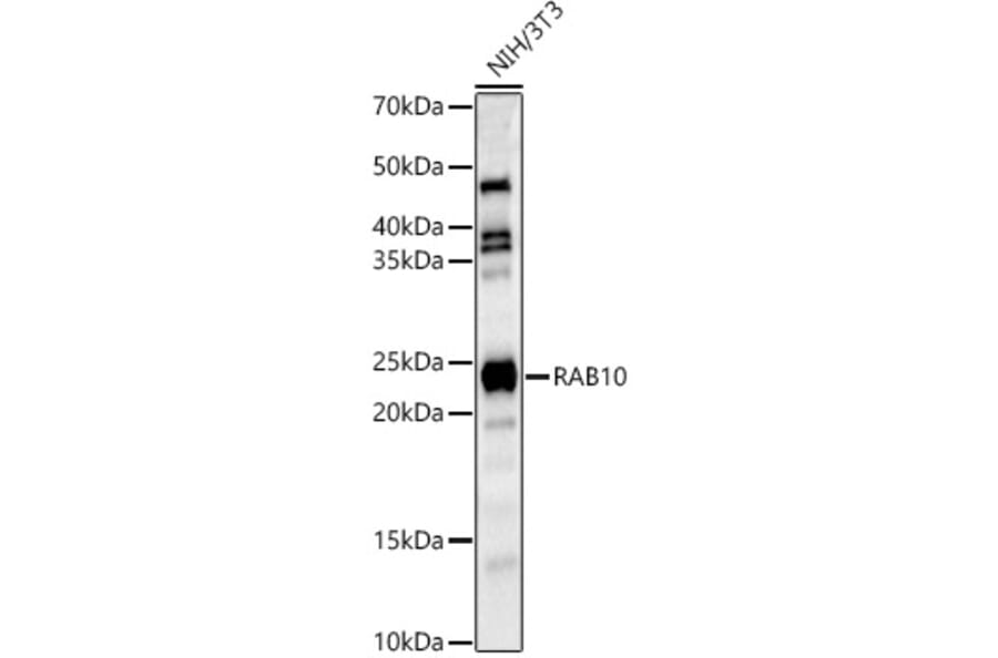 Western Blot - Anti-RAB10 Antibody (A14571) - Antibodies.com