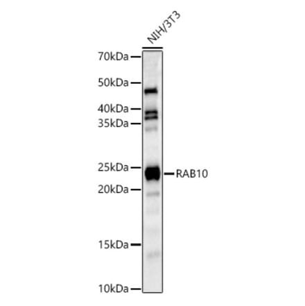 Western Blot - Anti-RAB10 Antibody (A14571) - Antibodies.com
