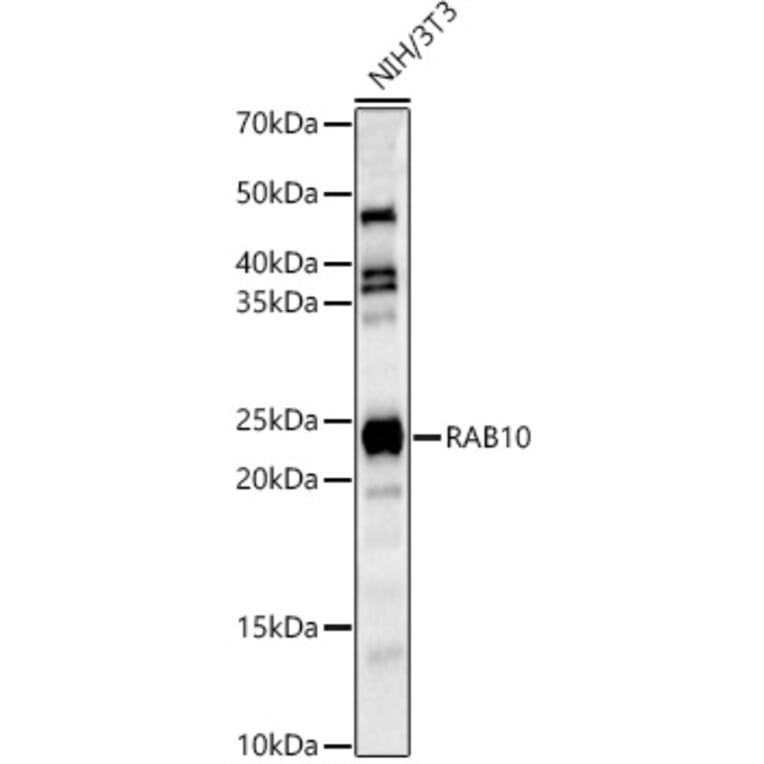 Western Blot - Anti-RAB10 Antibody (A14571) - Antibodies.com