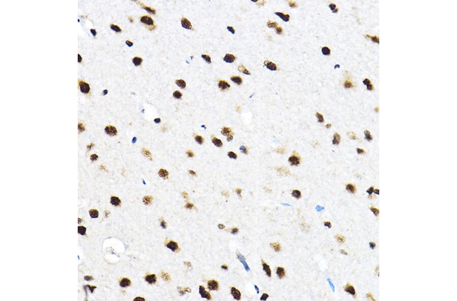 Immunohistochemistry - Anti-SF3A3 Antibody (A14572) - Antibodies.com
